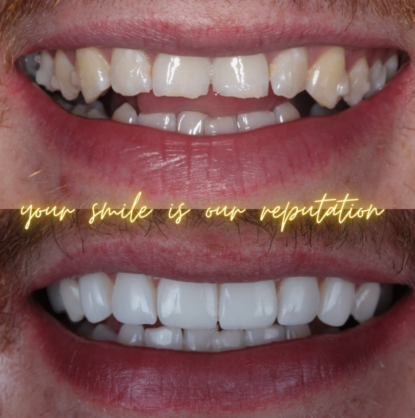 smile makeover in manchester