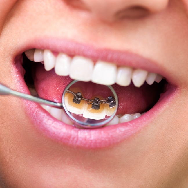 Treatment - Cheadle Hulme Dental