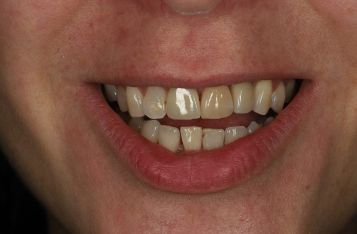 After - Cheadle Hulme Dental