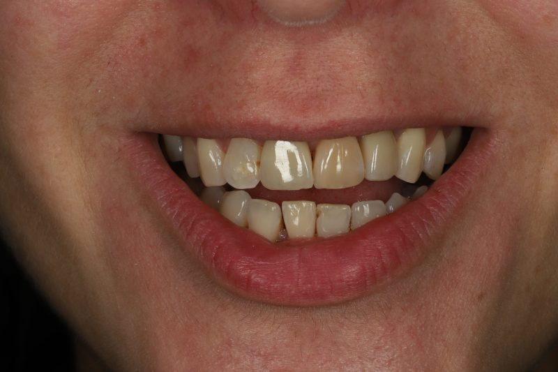 DE1 After - Cheadle Hulme Dental