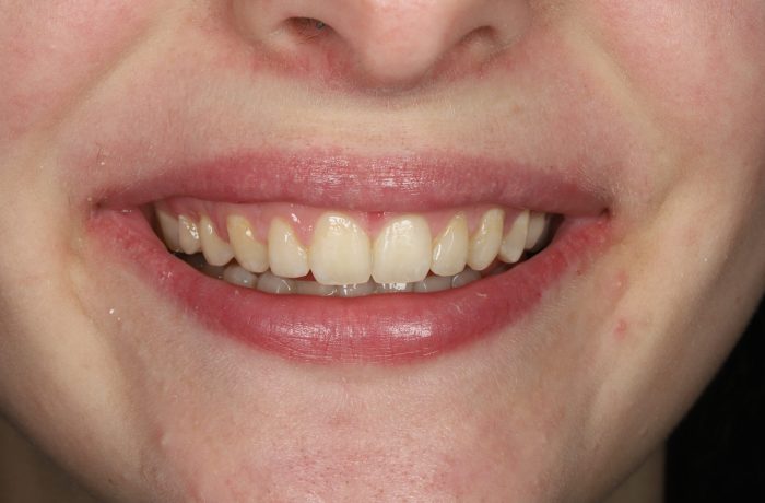 After - Cheadle Hulme Dental