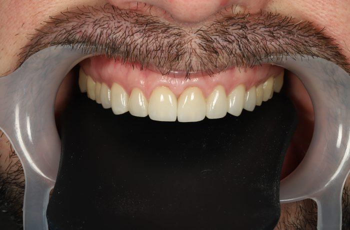 After - Cheadle Hulme Dental