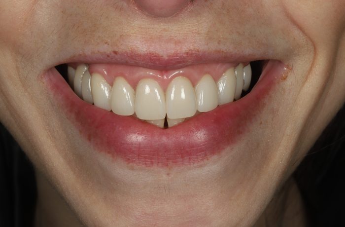 After - Cheadle Hulme Dental