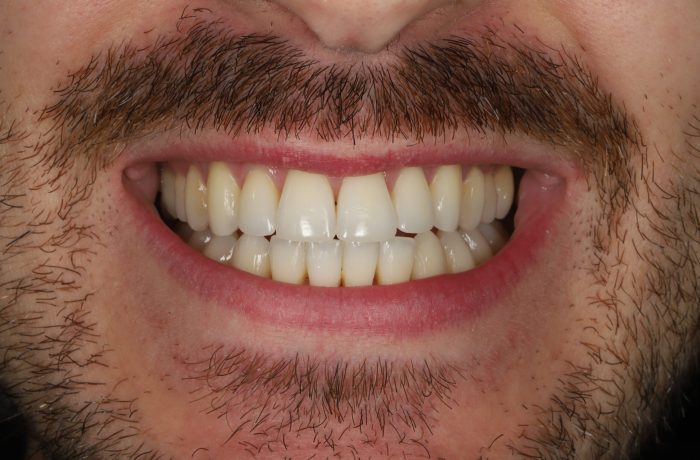 After - Cheadle Hulme Dental