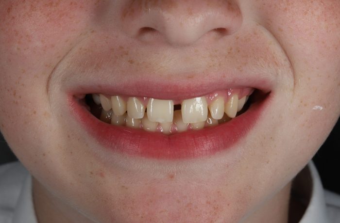 Before - Cheadle Hulme Dental