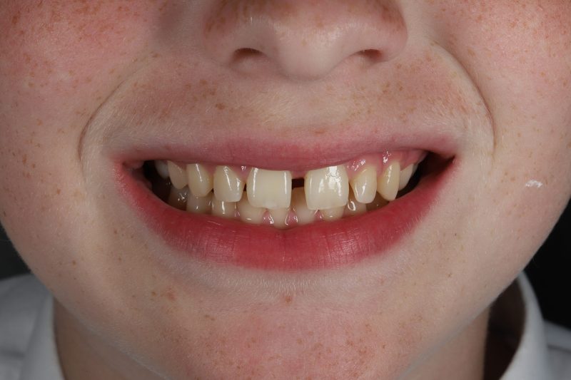 DE12 Before - Cheadle Hulme Dental