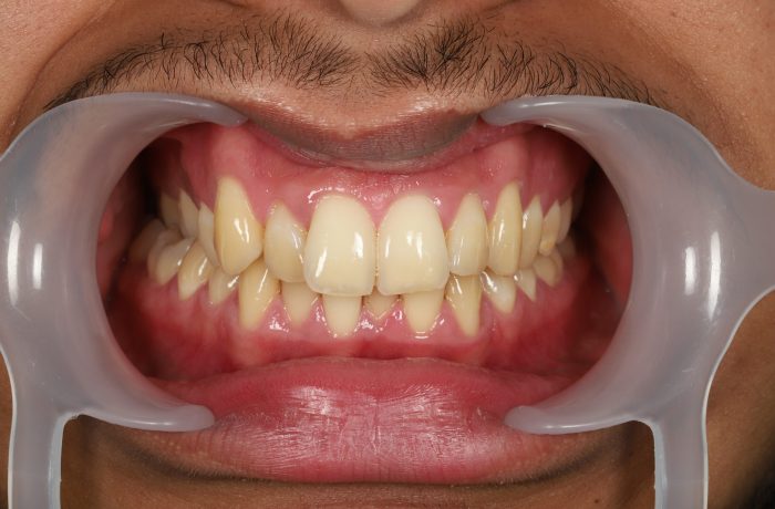 Before - Cheadle Hulme Dental