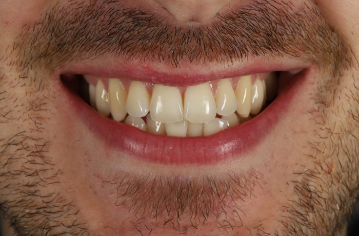 Before - Cheadle Hulme Dental