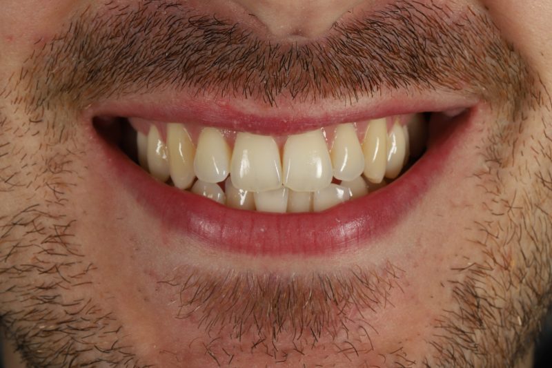 Before - Cheadle Hulme Dental