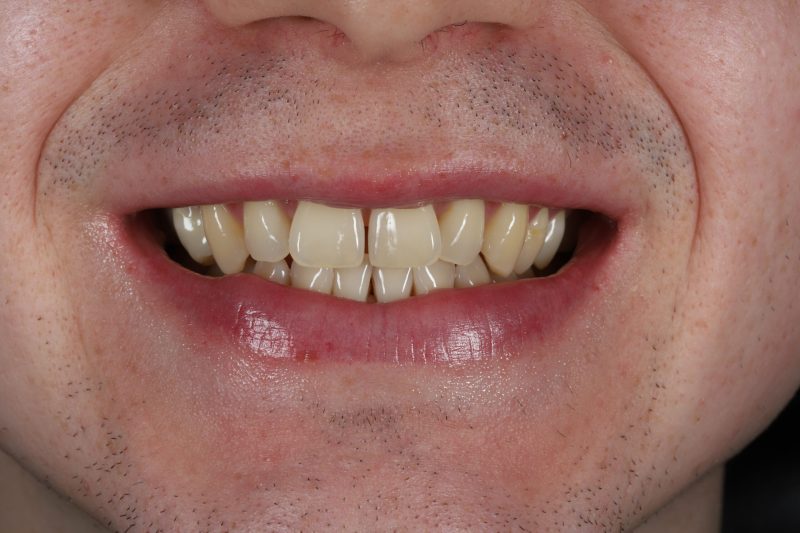 Before - Cheadle Hulme Dental