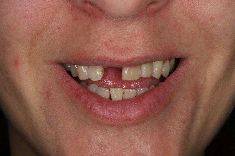 DE2 Before - Cheadle Hulme Dental