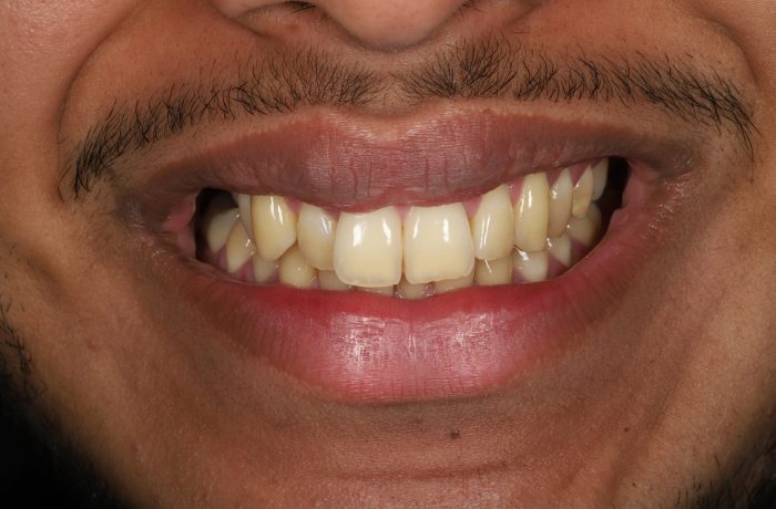 Before - Cheadle Hulme Dental