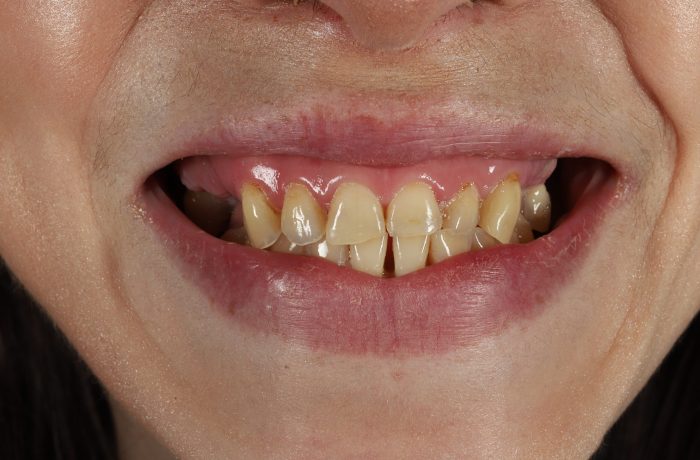 Before - Cheadle Hulme Dental