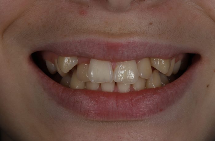 Before - Cheadle Hulme Dental