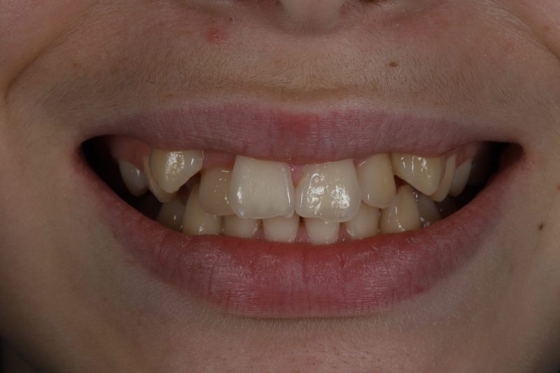 DE24 Before - Cheadle Hulme Dental