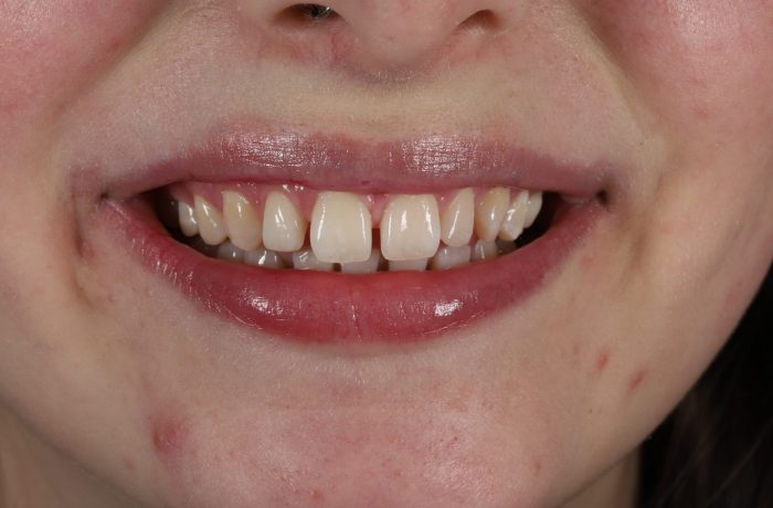 Before - Cheadle Hulme Dental