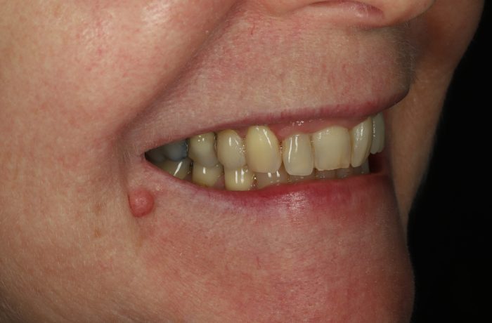 After - Cheadle Hulme Dental