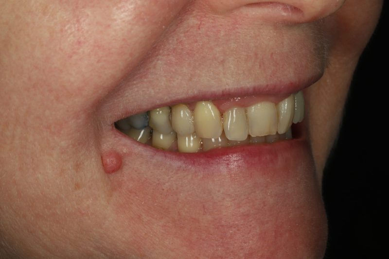 DE3 After - Cheadle Hulme Dental