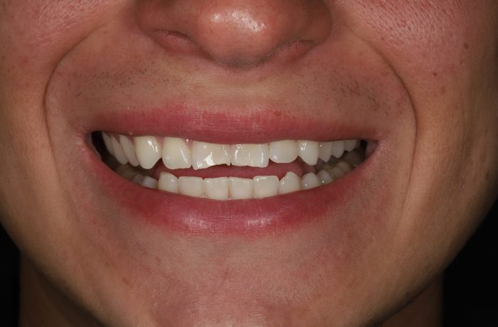Before - Cheadle Hulme Dental