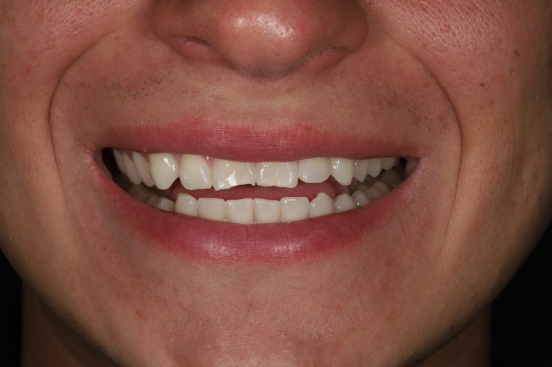 Before - Cheadle Hulme Dental