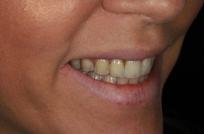 After - Cheadle Hulme Dental