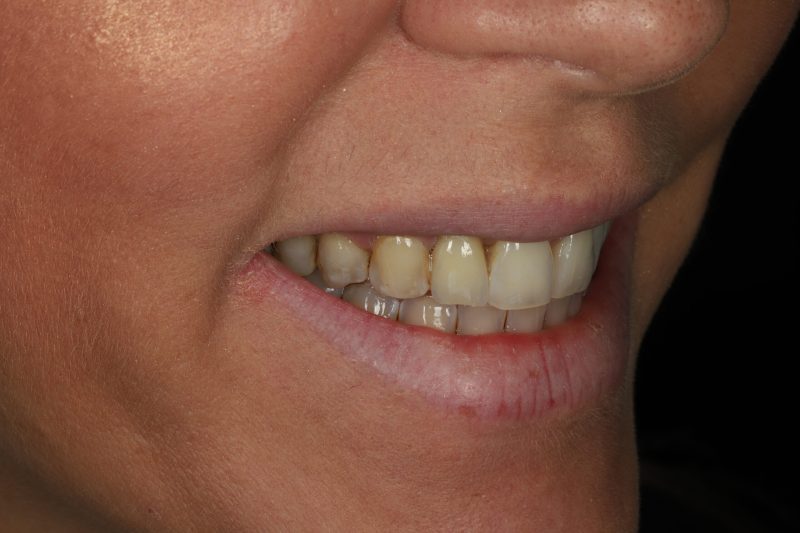 DE4 After - Cheadle Hulme Dental