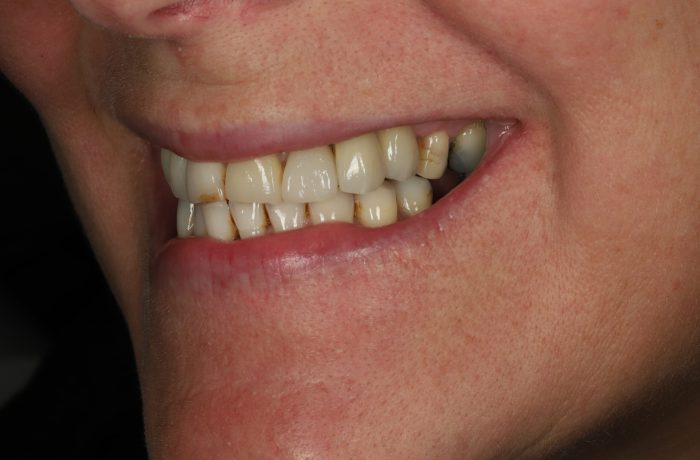 After - Cheadle Hulme Dental