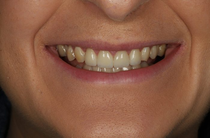 After - Cheadle Hulme Dental