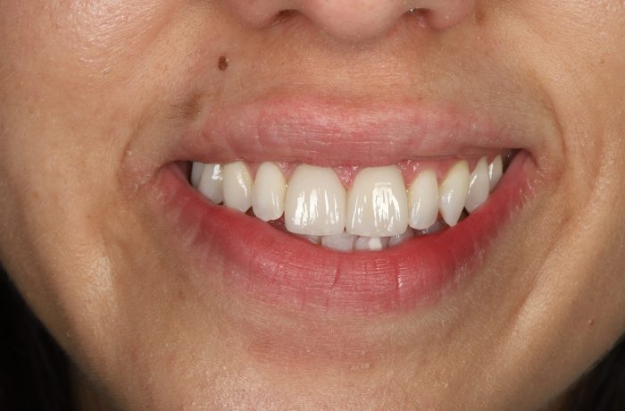 After - Cheadle Hulme Dental