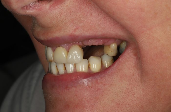 Before - Cheadle Hulme Dental