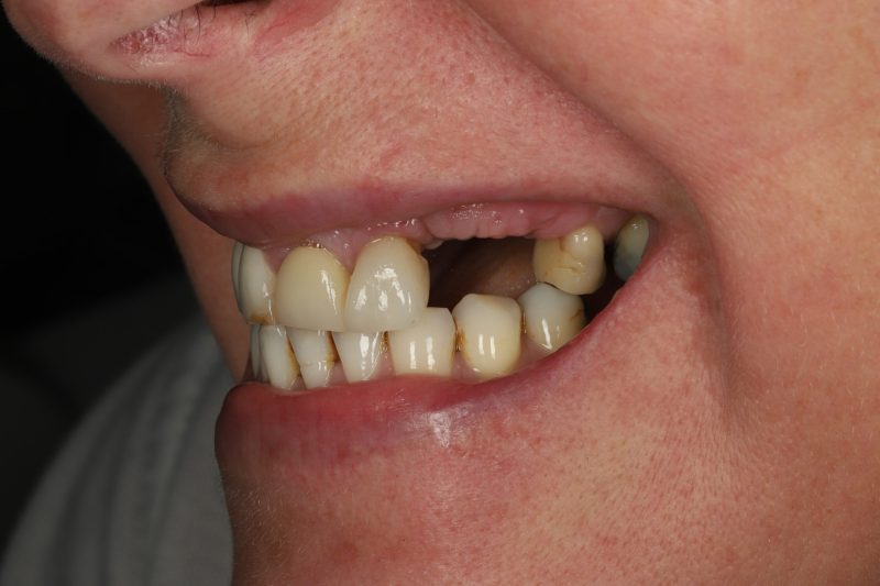 DE6 Before - Cheadle Hulme Dental