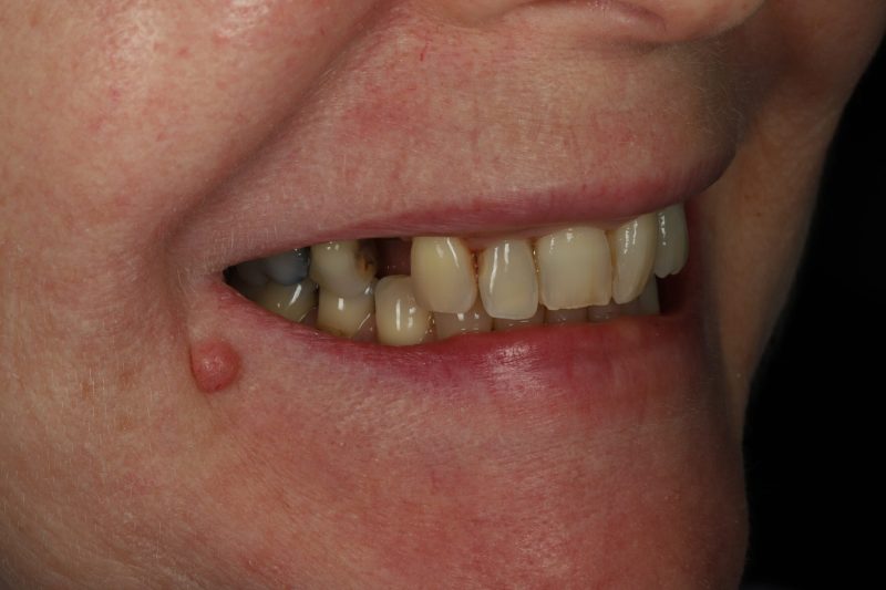 DE7 Before - Cheadle Hulme Dental
