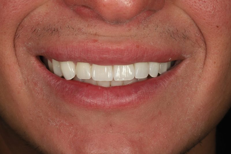 After - Cheadle Hulme Dental