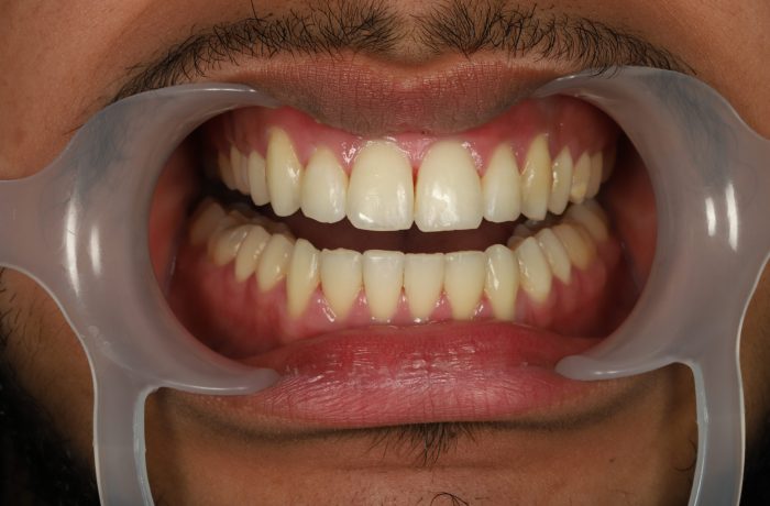 After - Cheadle Hulme Dental