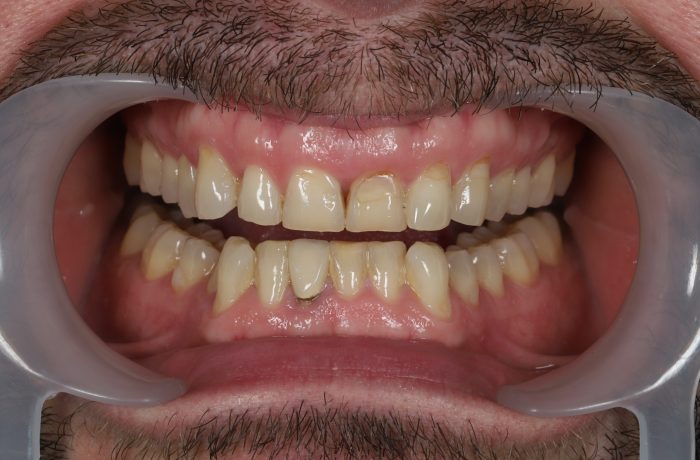 Before - Cheadle Hulme Dental