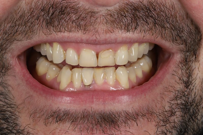 DE84 Before - Cheadle Hulme Dental