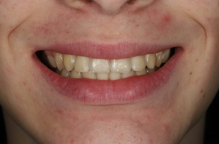 After - Cheadle Hulme Dental