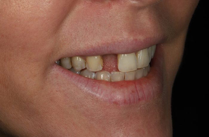 Before - Cheadle Hulme Dental