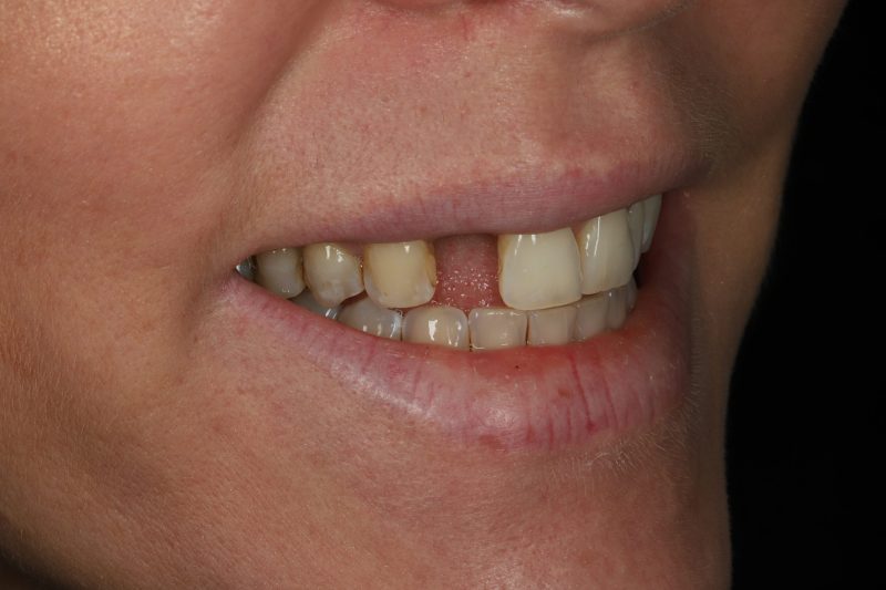 DE9 Before - Cheadle Hulme Dental