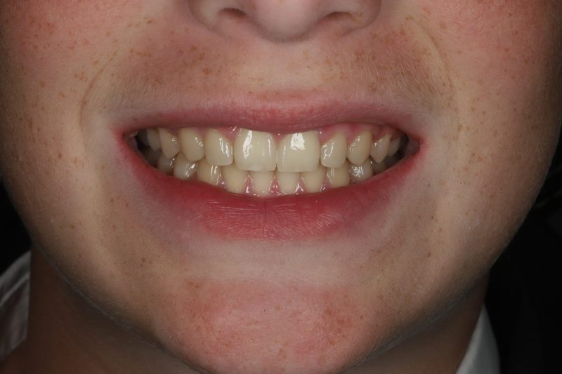 DE9 After - Cheadle Hulme Dental