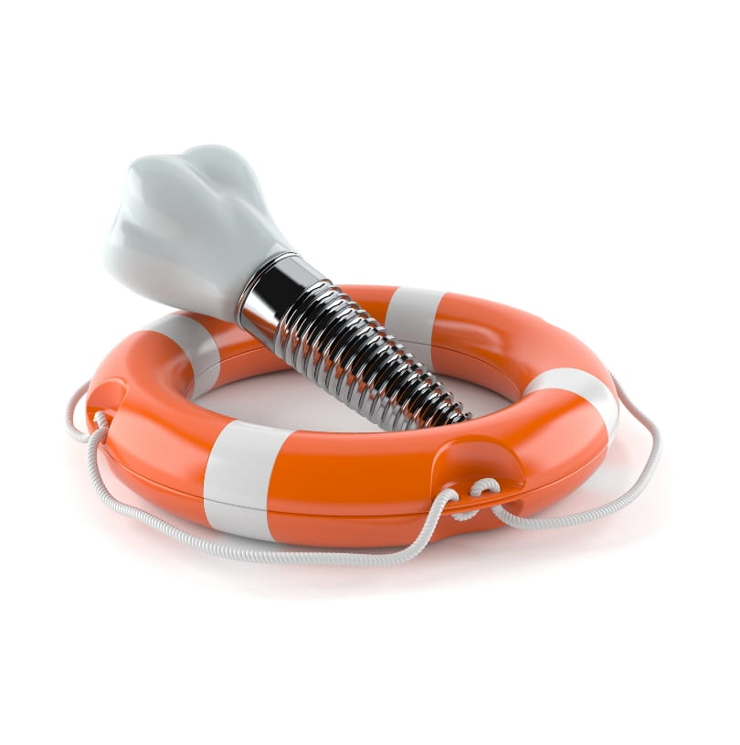 blog - Cheadle Hulme Dental