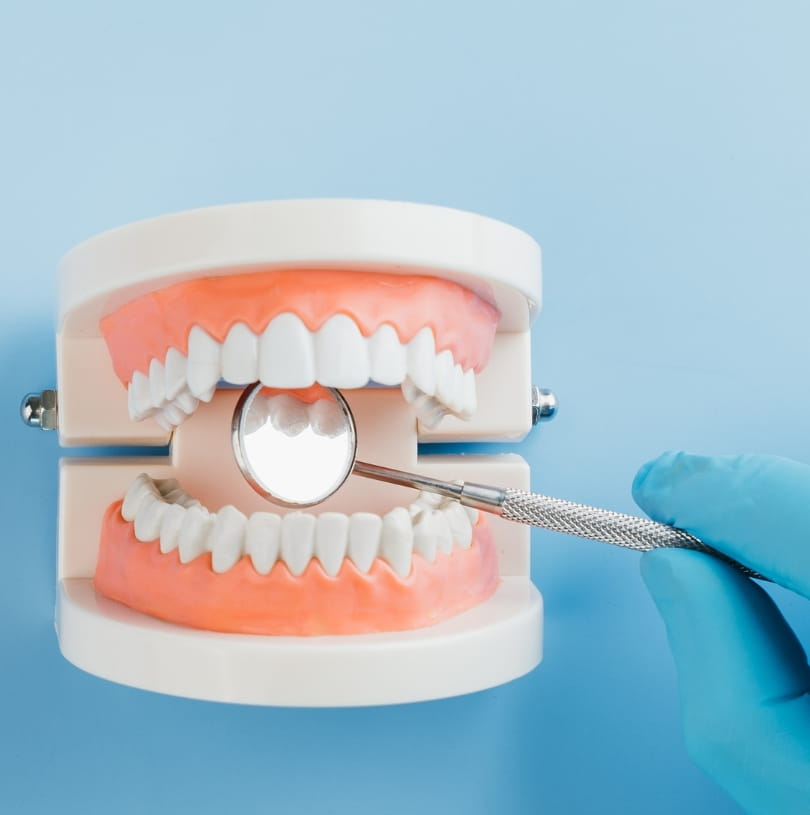 blog - Cheadle Hulme Dental