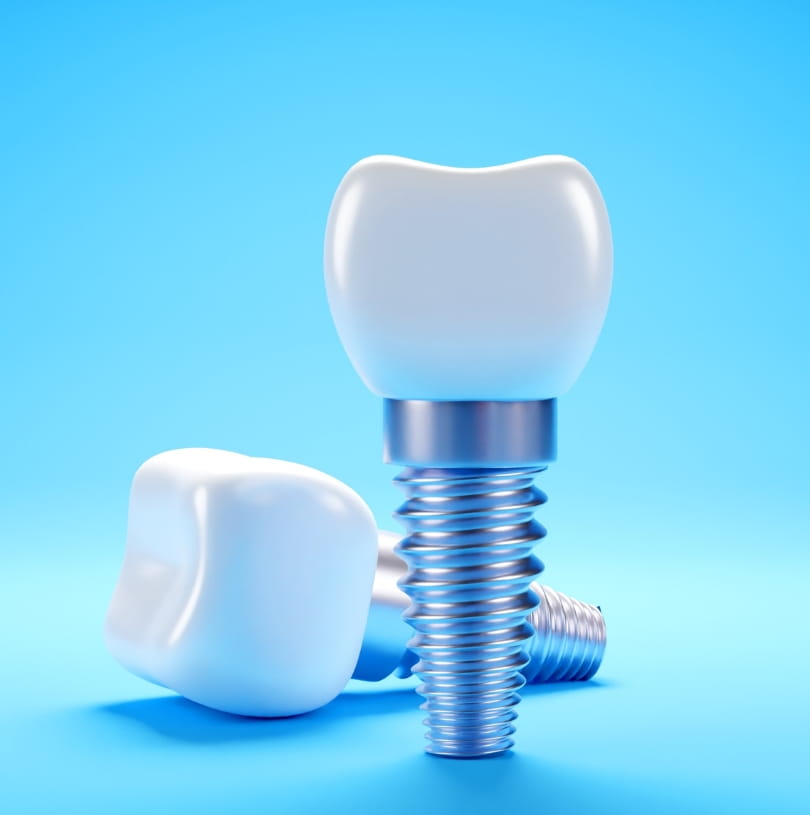 blog - Cheadle Hulme Dental