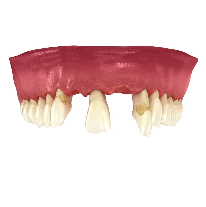 blog - Cheadle Hulme Dental