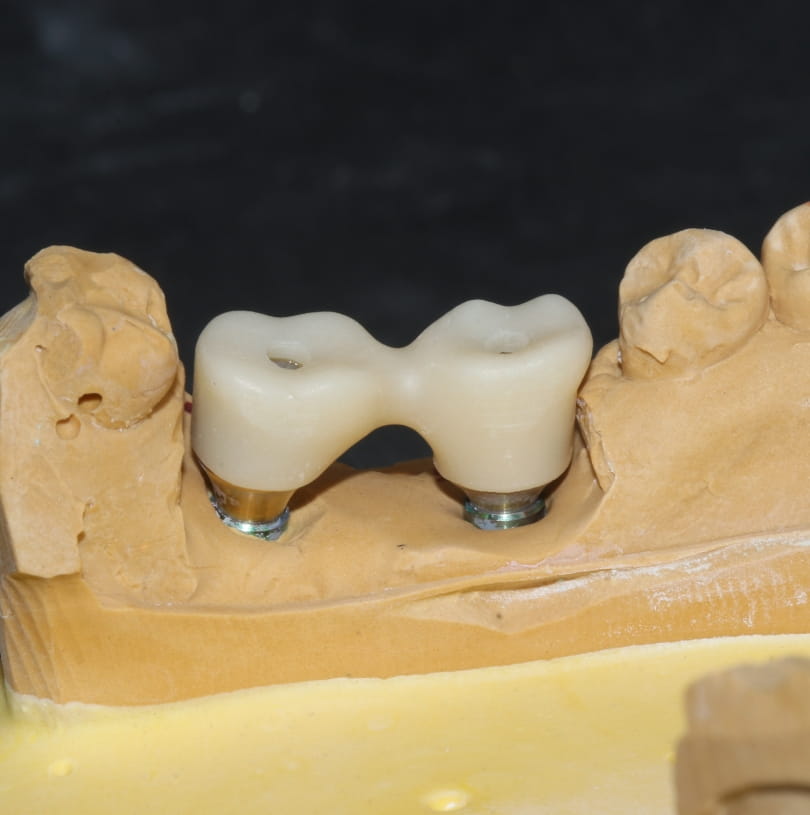 blog - Cheadle Hulme Dental