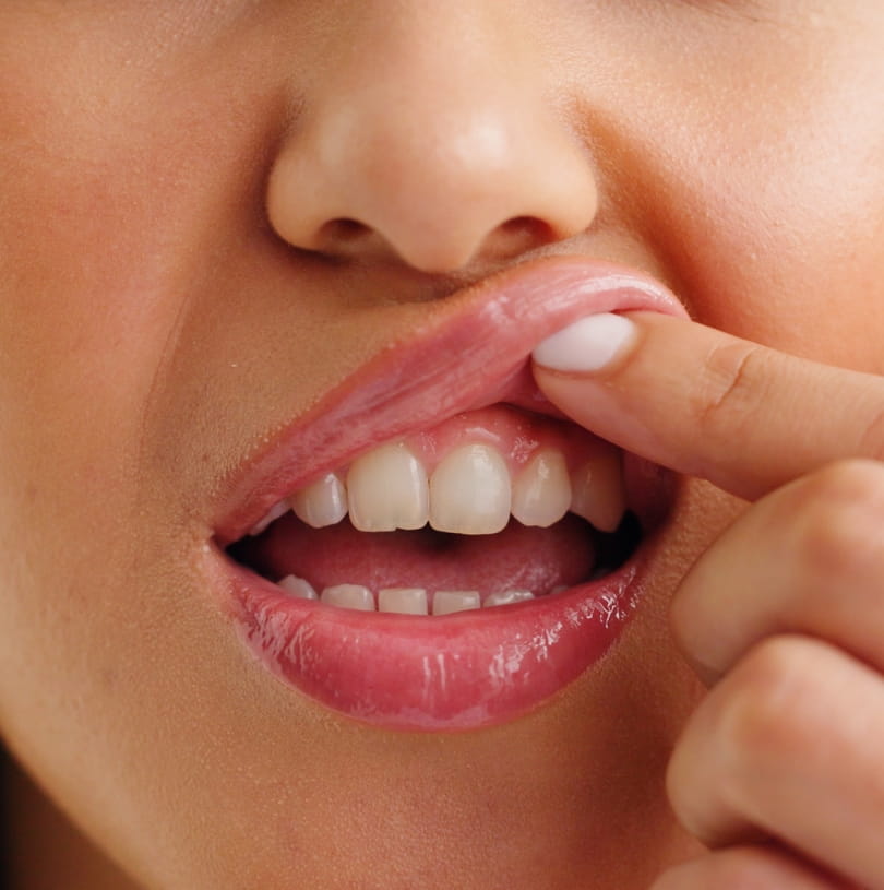 blog - Cheadle Hulme Dental