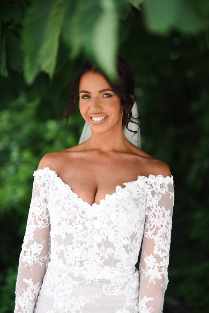 wedding smile makeover in manchester