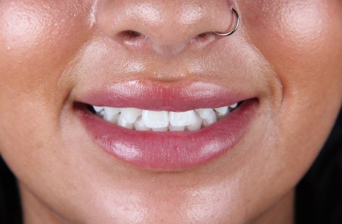 Before - Cheadle Hulme Dental