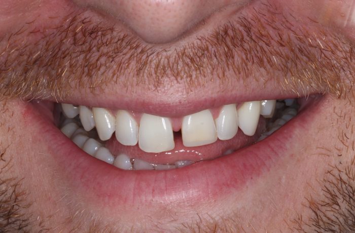 Before - Cheadle Hulme Dental