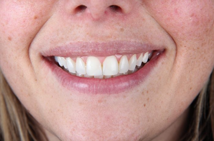 After - Cheadle Hulme Dental